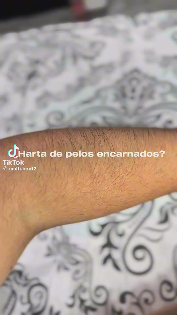 cansada de vellos encarnados depiladora laser